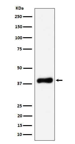 NSDHL Rabbit mAb