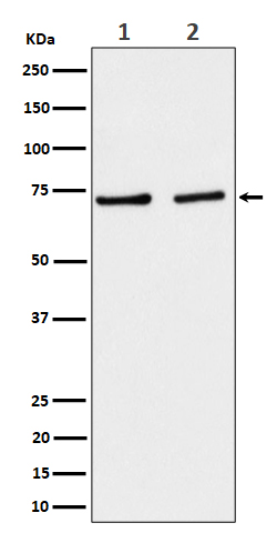 SLC25A12 Rabbit mAb