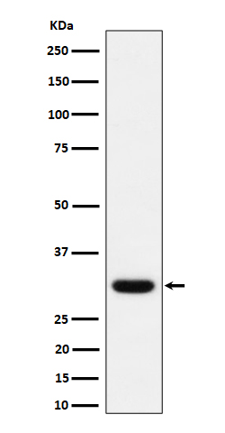 Adiponectin Rabbit mAb