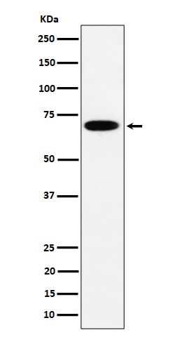 SLC27A4 Rabbit mAb