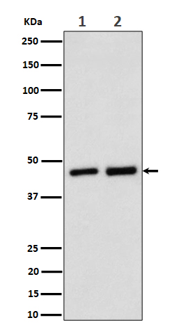 Annexin A7 Rabbit mAb