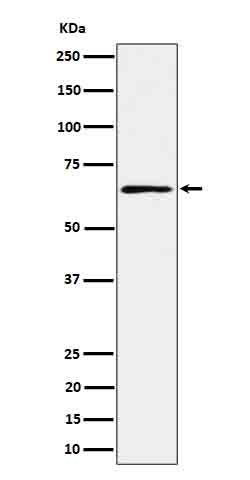 RIP2 Rabbit mAb