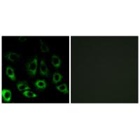 S2P Polyclonal Antibody