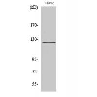 UBE3C Polyclonal Antibody