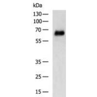 AFP Antibody