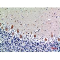 CD158e Polyclonal Antibody