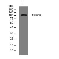 TRPC6 rabbit pAb