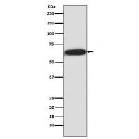 S6K1 (Phospho-Thr421/Ser424) Rabbit mAb 