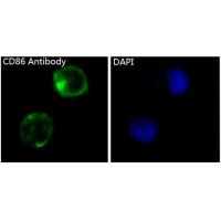 CD86 Rabbit mAb 