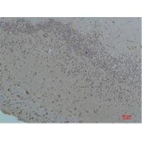 Bestrophin-1 Polyclonal Antibody