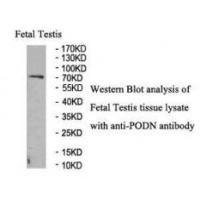 PODN Antibody