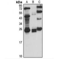 RBPMS Polyclonal Antibody