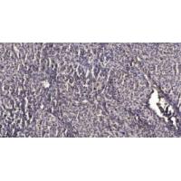 PDK2 Polyclonal Antibody