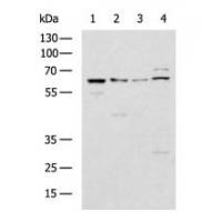 GBA Antibody