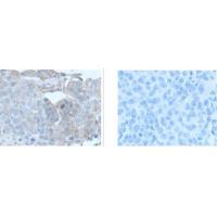 GBA Antibody