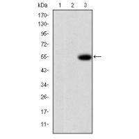 MMP-9 Monoclonal Antibody