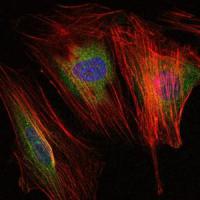 MMP-9 Monoclonal Antibody