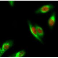 Estrogen Receptor-a Antibody