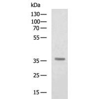 CFHR1 Antibody