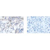 CAMTA1 Antibody