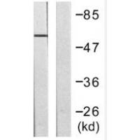 WASP  (Phospho-Tyr291) Antibody