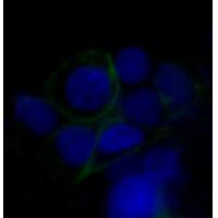 Glucose Transporter GLUT1 Rabbit mAb