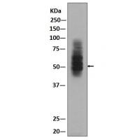 Glucose Transporter GLUT1 Rabbit mAb