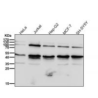 NFkB p105/p50 Rabbit mAb