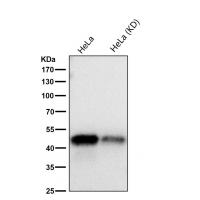 NFkB p105/p50 Rabbit mAb