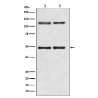 NFkB p105/p50 Rabbit mAb