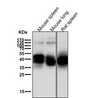 NFkB p105/p50 Rabbit mAb