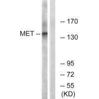 MET Antibody