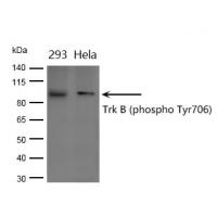 Trk B (phospho Tyr706) Polyclonal Antibody