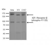 IGF-I Receptor β (phospho-Tyr1135)  rabbit pAb