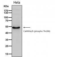 CaMKIIα/δ (phospho Thr286) Polyclonal Antibody