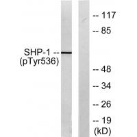 SHP-1(Phospho-Tyr536) Antibody