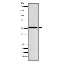 Activin A Receptor Type IB Rabbit mAb