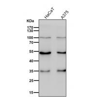 Activin A Receptor Type IB Rabbit mAb