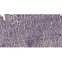 TBX2 Polyclonal Antibody