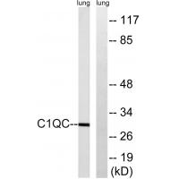 C1q-C Polyclonal Antibody