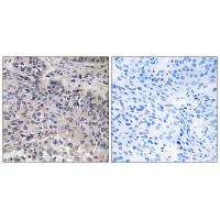 C1q-C Polyclonal Antibody