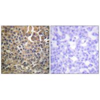 HER4 (Phospho-Tyr1284) Antibody