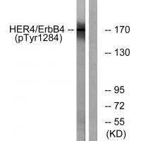 HER4 (Phospho-Tyr1284) Antibody