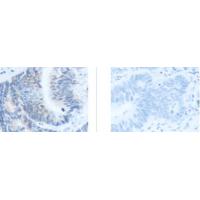 PDCD1LG2 Antibody