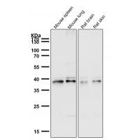 CCR2 Rabbit mAb