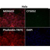 CCR2 Rabbit mAb