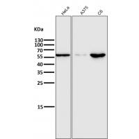 E2F1 Rabbit mAb