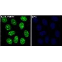 E2F1 Rabbit mAb