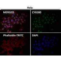 E2F1 Rabbit mAb