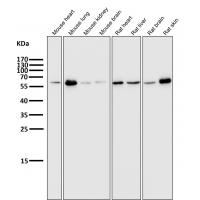 E2F1 Rabbit mAb